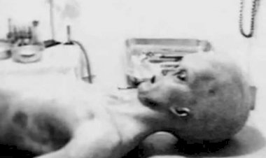 Incidentul Roswell Autopsii Pe Extraterestrii?